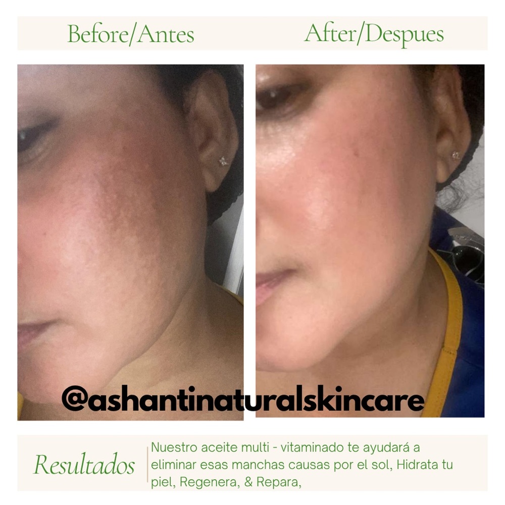 Multi-Vitaminado Aceite